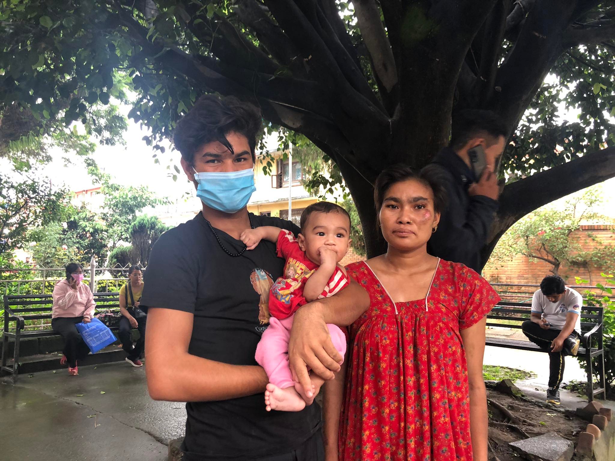 आगोले जलेकि बाजुराकी २३ बर्षयि लोकशरीको उपचार