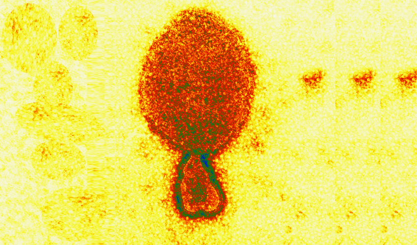 चीनमा जनावरबाट सर्ने नयाँ भाइरसको सङ्क्रमण देखियो