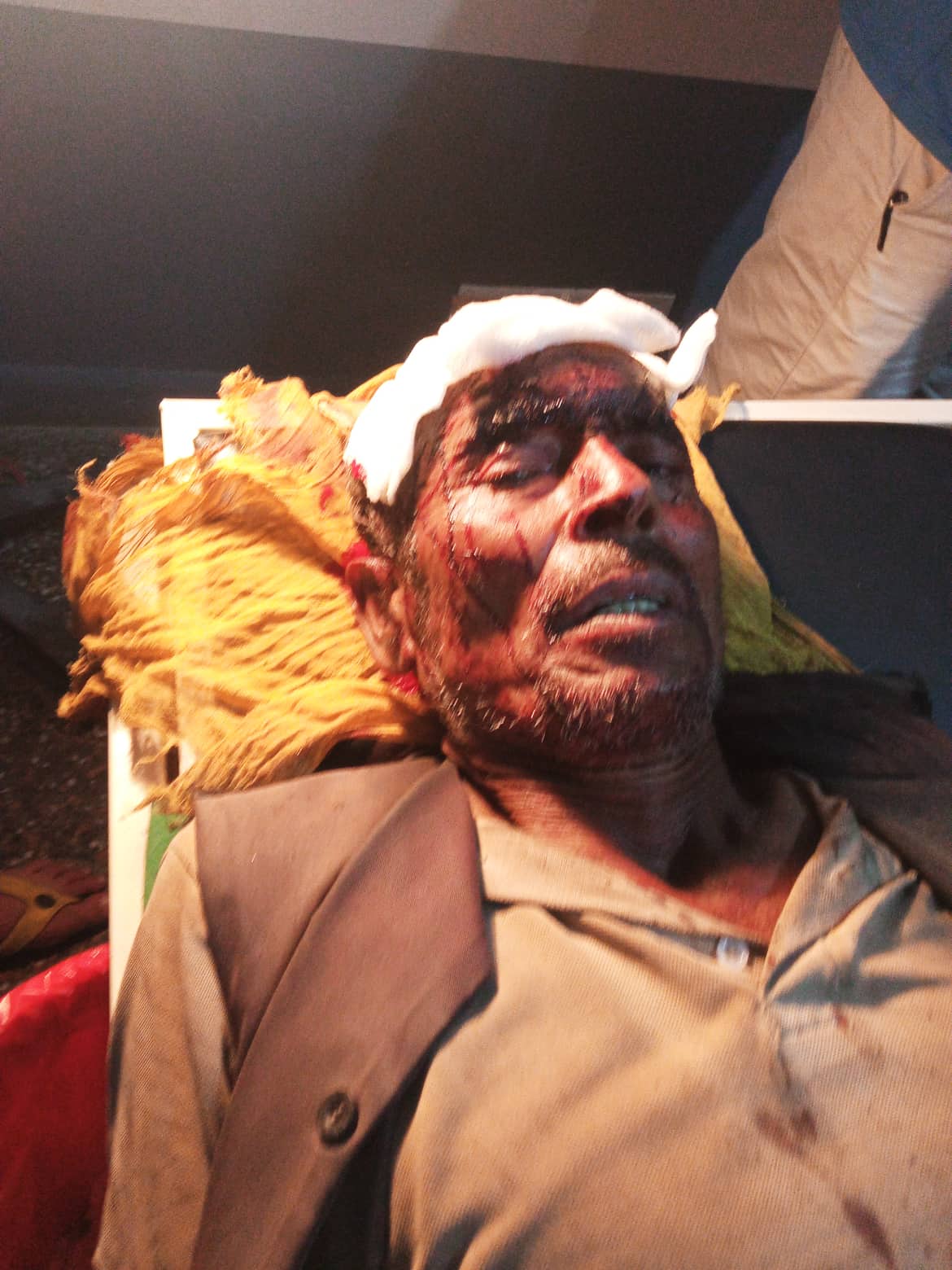 अछाममा भालुको आक्रमण बाट एकजना गम्भिर घाइते