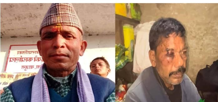 दलितमाथि कुटपिट आरोप लागेका बाजुराका वडा अध्यक्ष १ लाख धरौटिमा छुटे