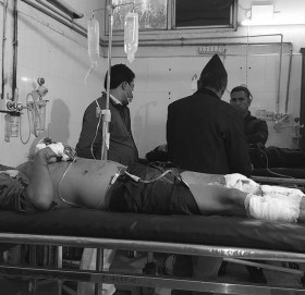 बनाउँदै गरेको बम कोठामै विस्फोट, विप्लवका दुई कार्यकर्ता घाइते