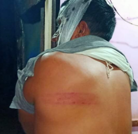 बैतडीको मेलौलीमा अस्पताल निर्माणको विषयमा झडप, ३५ जना घाइते