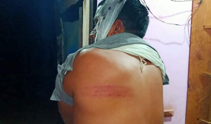 बैतडीको मेलौलीमा अस्पताल निर्माणको विषयमा झडप, ३५ जना घाइते