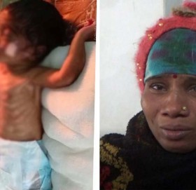 अस्पतालले मृत घोषित गरेका शिशुले शास फेरेपछि…