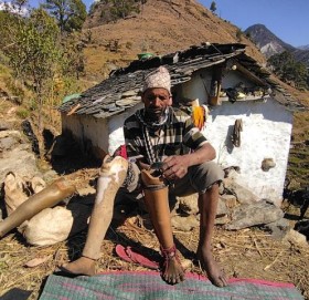 आर्थिक अभावमा कृत्रिम खुट्टा हाल्न समस्या