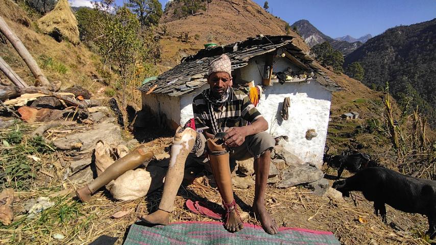 आर्थिक अभावमा कृत्रिम खुट्टा हाल्न समस्या