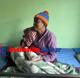 आगोले जलेकी बाजुरकी सुर्पनाको काठमाडौमा उपचार पछि सञ्चो