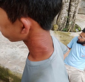 वडाध्यक्षले कार्यालयभित्रै कुटे सेवाग्राही