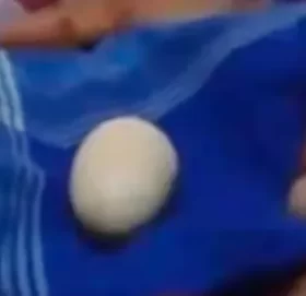 अनौठो घटना : अण्डा पार्ने १४ वर्षिय युवक