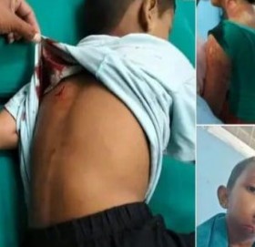 बझाङमा आमाछोरालाई छुरा प्रहार गर्ने व्यक्ति कैलालीबाट पक्राउ