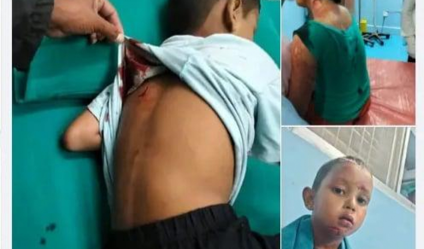 बझाङमा आमाछोरालाई छुरा प्रहार गर्ने व्यक्ति कैलालीबाट पक्राउ