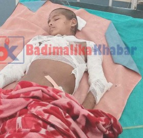 पैसा अभाबमा शरिर जलेका १३ बर्षिय  चरिन्द्र जिवन मरणको दोसाधमा