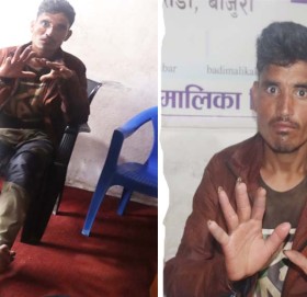 हिमालीका दिल कुष्ठरोग लागेको भन्दै घरपरिवार र समाज बाट तिस्कार