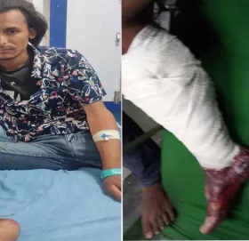 भुकम्पमा परि खप्तड छेडेदह ४ का दिर्घ धामीको दाँया खुट्टा भाचियो, धनगढीमा उपचार हुदै