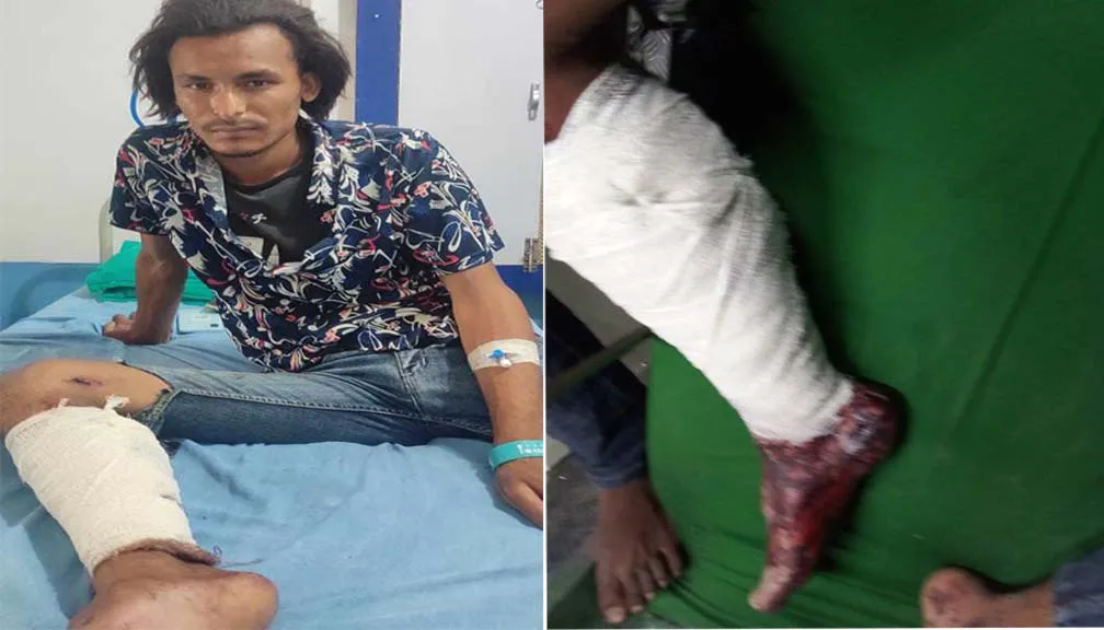 भुकम्पमा परि खप्तड छेडेदह ४ का दिर्घ धामीको दाँया खुट्टा भाचियो, धनगढीमा उपचार हुदै