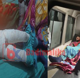 आगोले जलेर घाइते जेसिकाको बडिमालिका फाउण्डेसन नेपालको समन्वयमा उद्धार