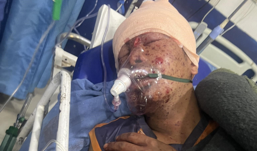 भाँसु भिरमा द्धन्दकालमा राखेको एम्बुस विस्फोट हुदा चार जना घाईते