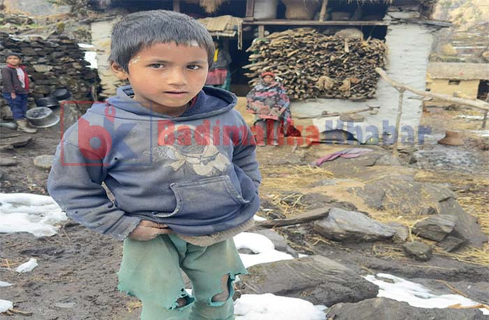 आर्थिक अभावले उपचार नपाउँदा ७ बर्षीय बालक अलपत्र