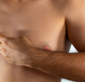 पुरुषमा पनि देखिंदैछ स्तन क्यान्सर, कारण के ?