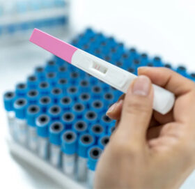 जागिरका लागि सीप होइन, महिला आवेदकको गर्भ परीक्षण !