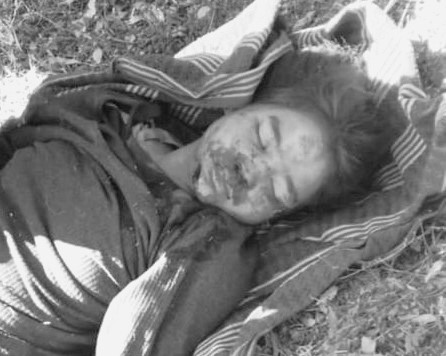 बाजुरामा भीरबाट लडेर घाइते भएकी बालिकाको मृत्यु