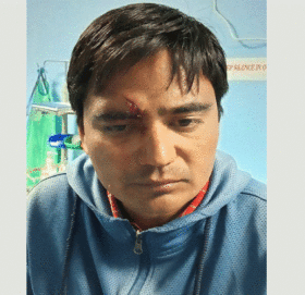 नेपाल पत्रकार महासंघ बझाङ शाखाका अध्यक्ष सिंहमाथि चक्कु प्रहार