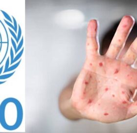 नेपाल रुबेलामुक्त भएको विश्व स्वास्थ्य सङ्गठको घोषणा