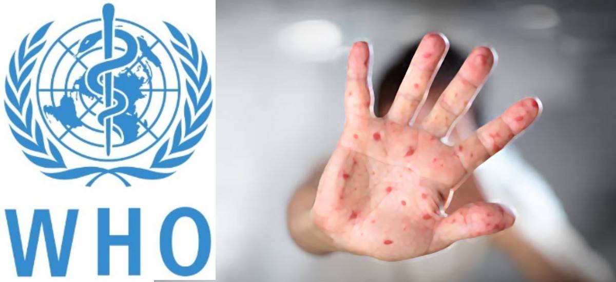 नेपाल रुबेलामुक्त भएको विश्व स्वास्थ्य सङ्गठको घोषणा