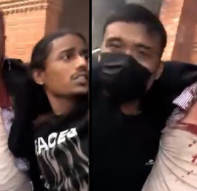 देउवाको टाउकोमा १२ वटा टाँका लगाइयो, केही दिन अस्पतालमै रहने